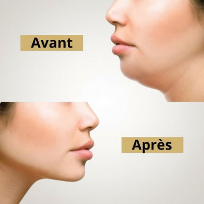 Bandeau amincissant visage - Masque pour lifting du visage réutilisable