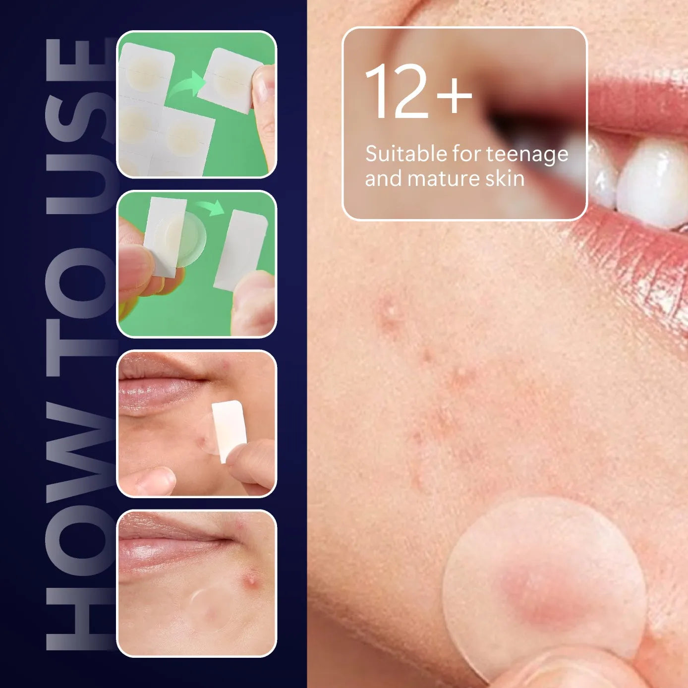Patchs anti-acné à l'acide hyaluronique – Patchs invisible et hydratant 12/24Pcs