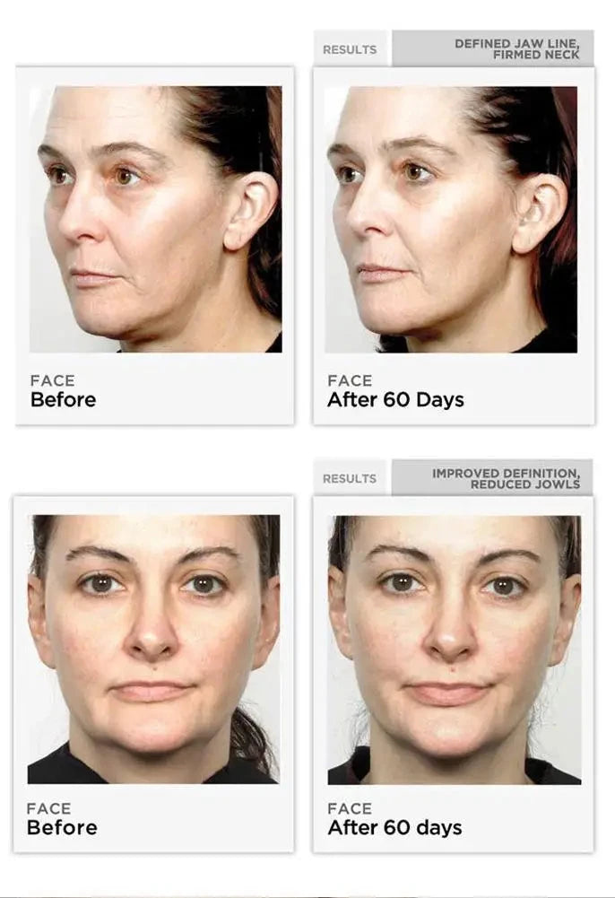 EMS – Appareil de massage pour lifting, dispositif facial à microcourant - Outil de sculpture du visage