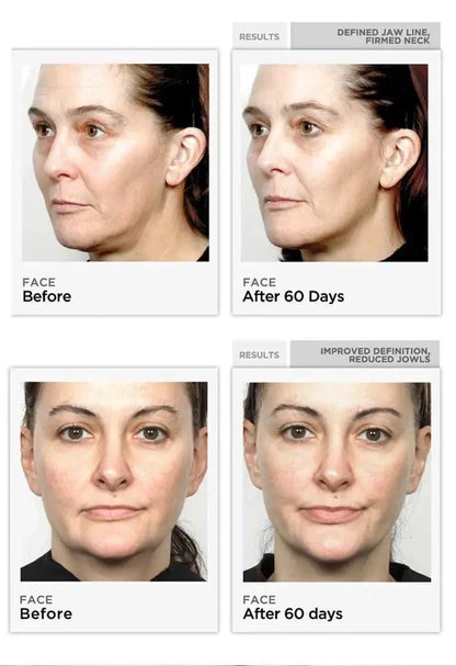 EMS – Appareil de massage pour lifting, dispositif facial à microcourant - Outil de sculpture du visage